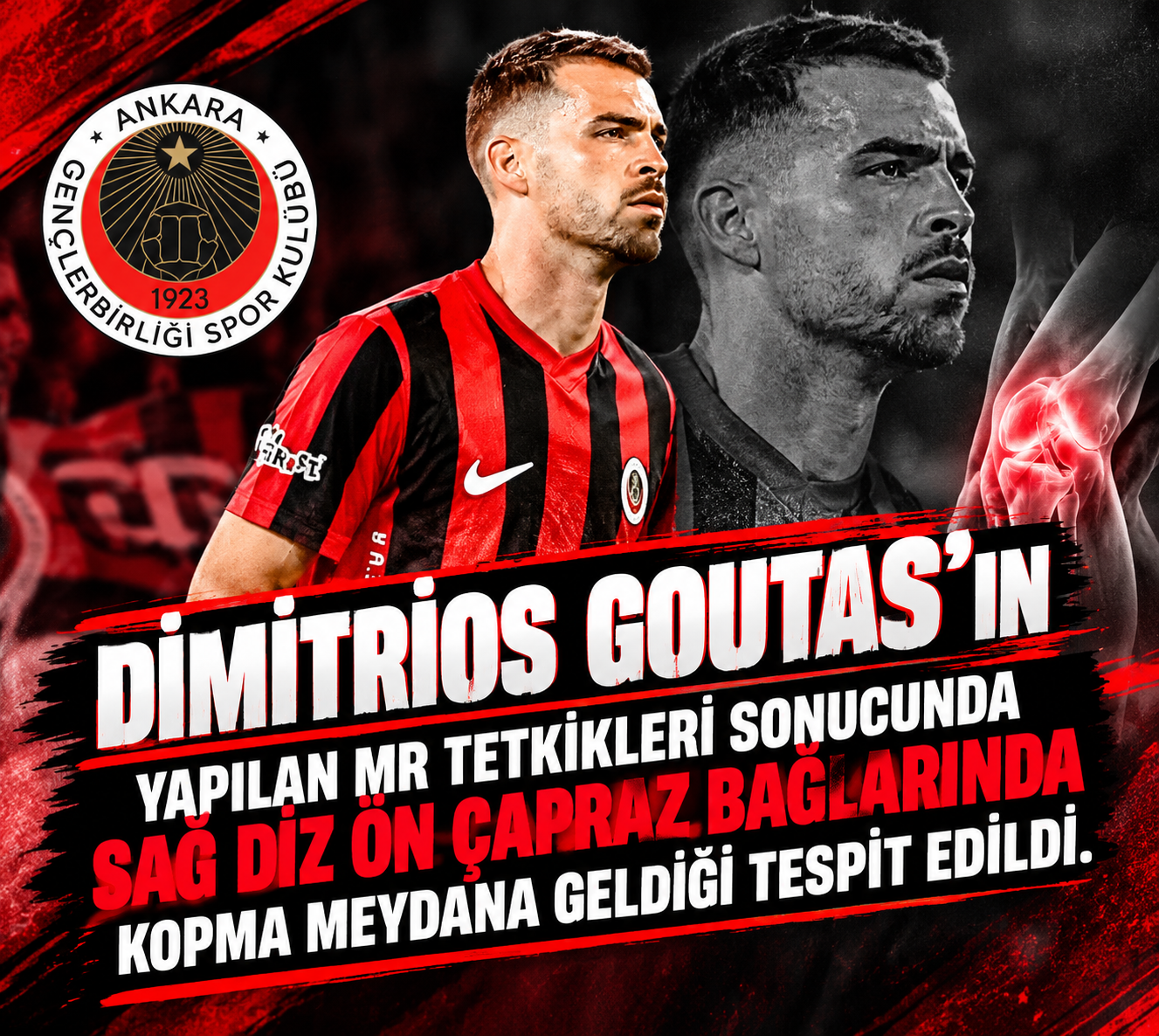 Goutas’ın MR Sonucu Açıklandı: Ön Çapraz Bağlarında Kopma Tespit Edildi